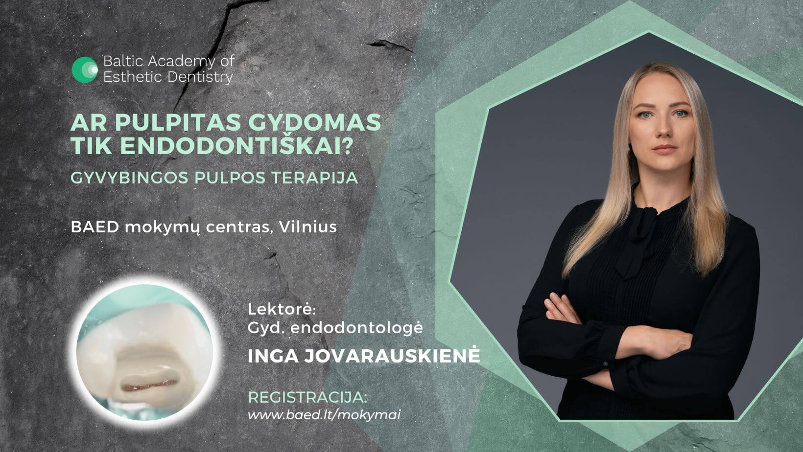 Inga Jovarauskienė - Pulpos terapija
